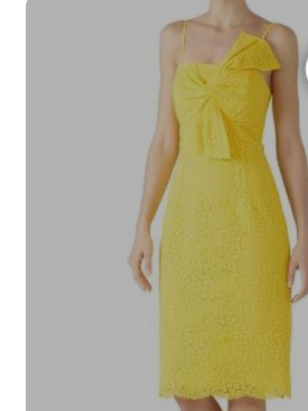 Trina Turk Yellow Midi Dress with Front Bow Detail twist bow